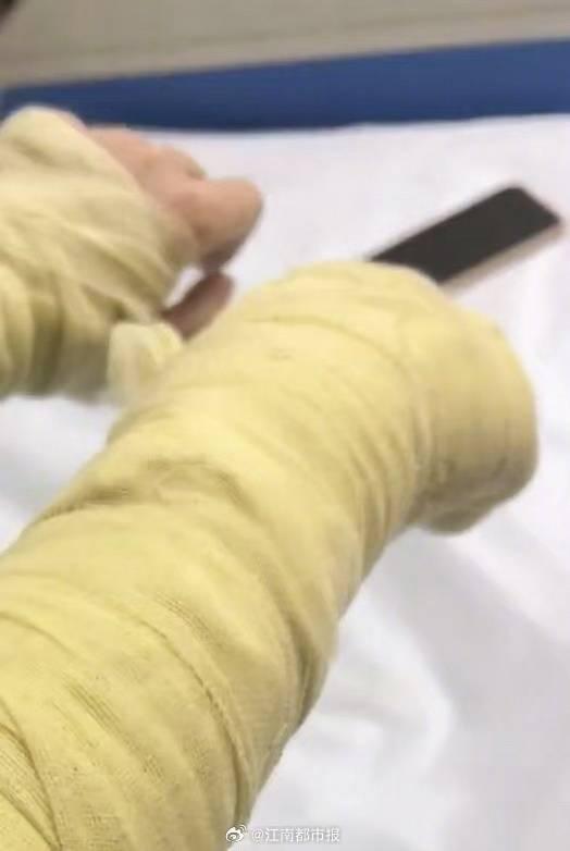 当地公安回应主播收到炸弹包裹被炸伤:是有此事,正在进一步调查