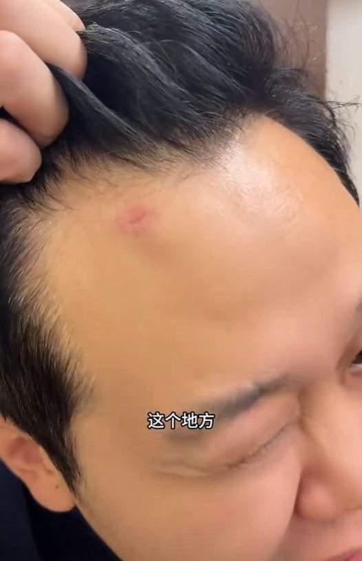 被抢中国球迷:墨西哥警察来了先要钱 给了1万比索,随后警察就找不到了