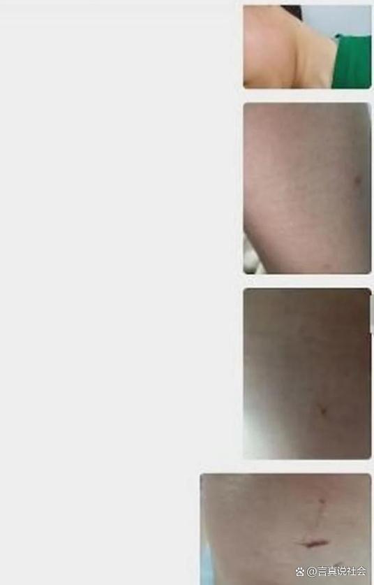 曝女生因举报老师开补习班被殴打校方无中生有公安局已在处理2