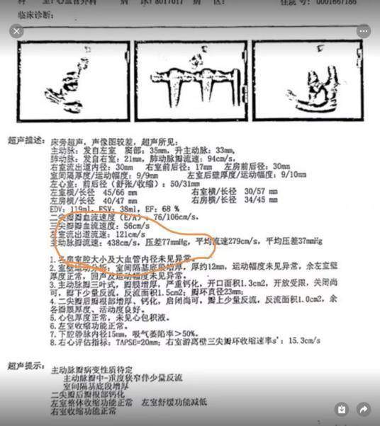 回应！西安交大一附院相关医生讲述团队给患者李某治疗事件全过程