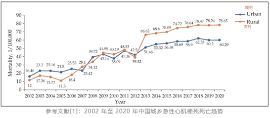 心梗发作5个预警信号