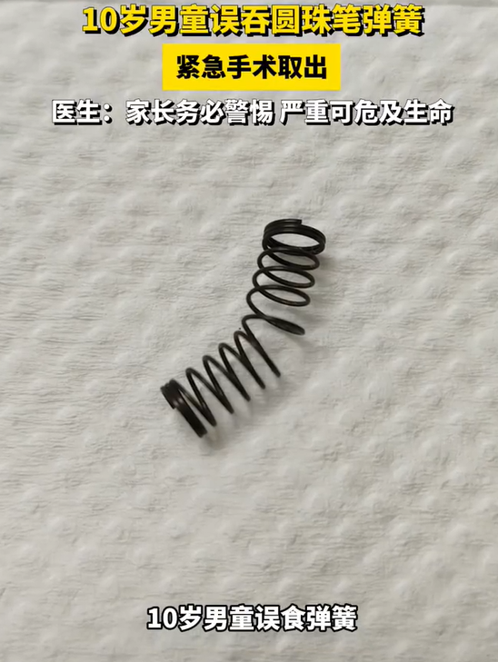 男童误吞圆珠笔弹簧手术取出 医生:家长务必警惕