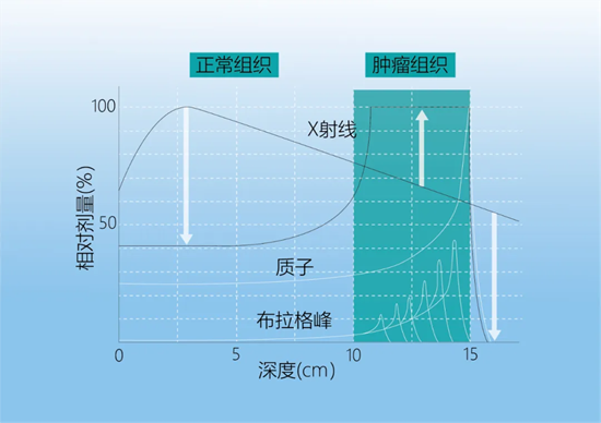 边治疗边工作——河北一洲肿瘤医院解读质子治疗重塑前列腺癌生活方式