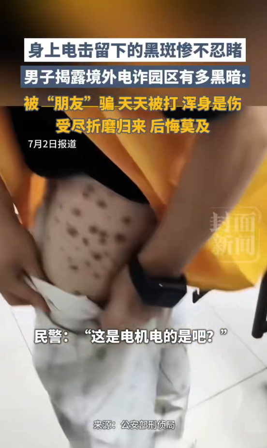 男子在柬埔寨被两次转卖惨不忍睹!