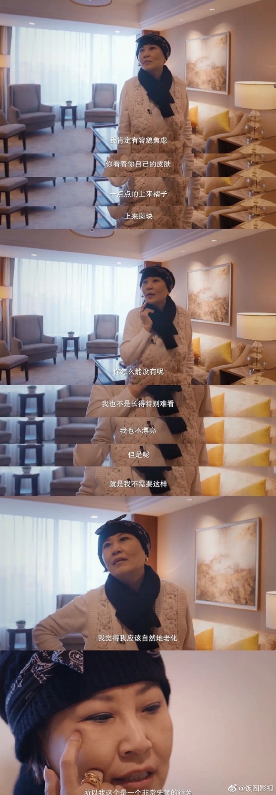 张蔷割眼袋失败喊话整容医生