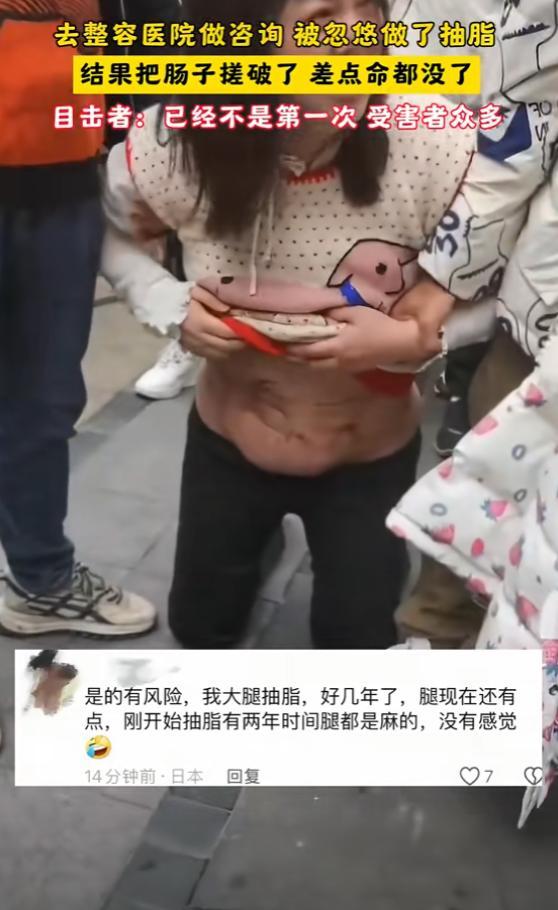 女子做抽脂手术肠子被戳破 美容机构事故频发