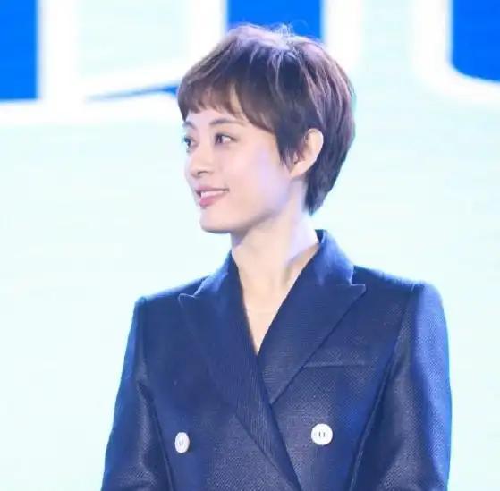 孙俪回应左眼受伤 运动意外引关注