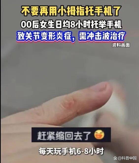用小拇指做手机支架的受害者出现了 长时间玩手机致变形?