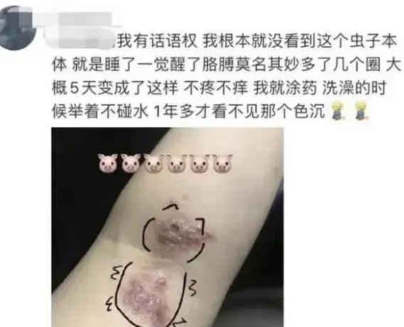 毒液堪比硫酸 一地确诊200多例！防护指南来了