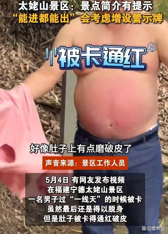 男子過一線天被卡肚子磨破皮