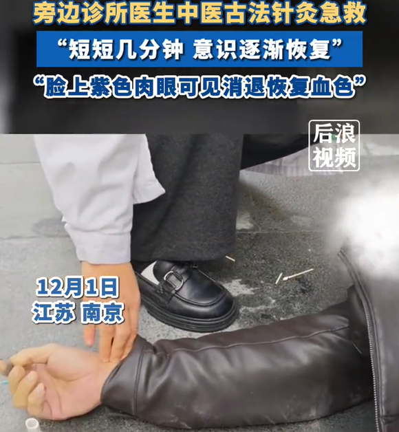 男子街头突然昏迷中医古法针灸救回