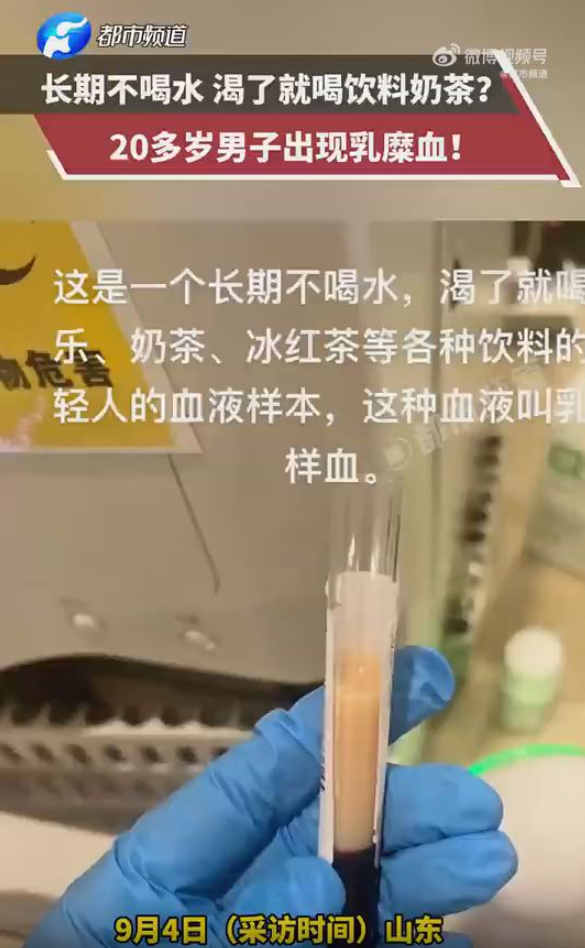 20岁小伙只喝奶茶饮料成牛奶血 警觉乳糜血危险