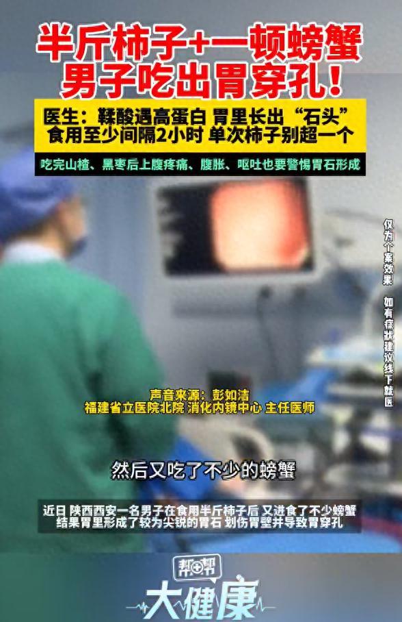 西安一男子吃柿子后又吃螃蟹胃穿孔