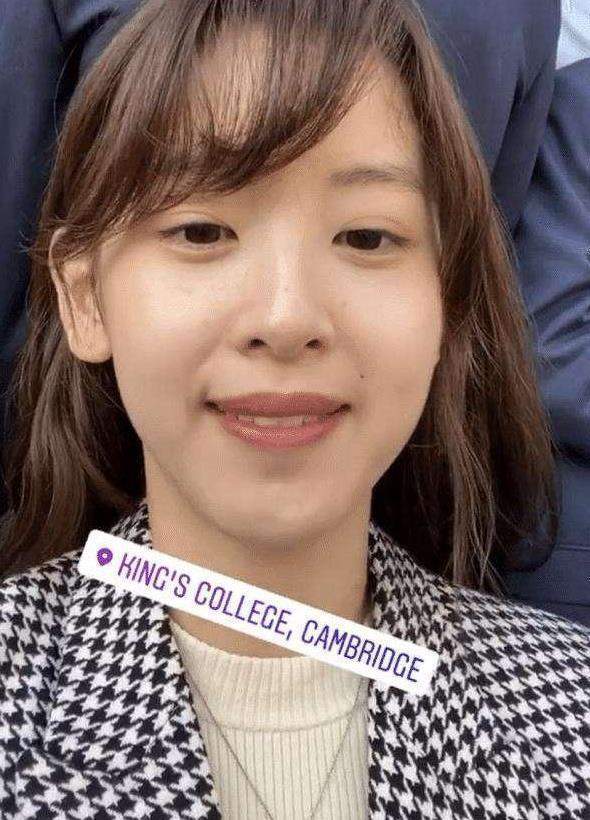 章泽天自曝家族有帕金森基因睡眠不足时手指发抖