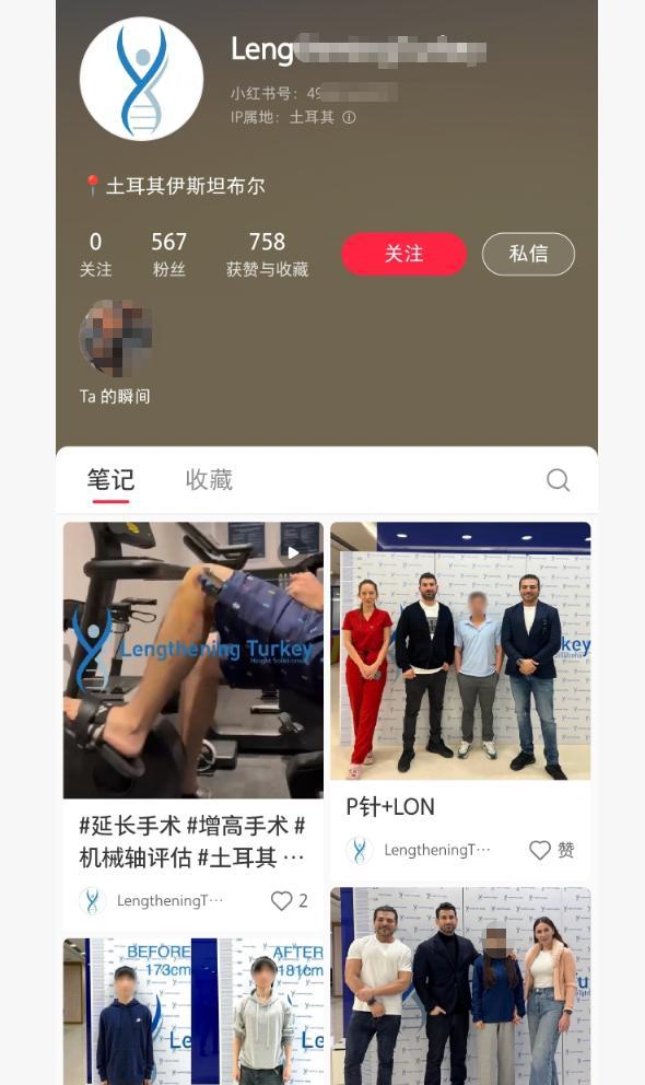 “断骨增高术”隐蔽宣传死灰复燃 多个平台再现违规账号