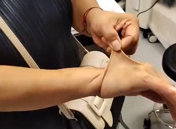 女子得罕見病 皮膚如橡皮人 胞姐首例確診