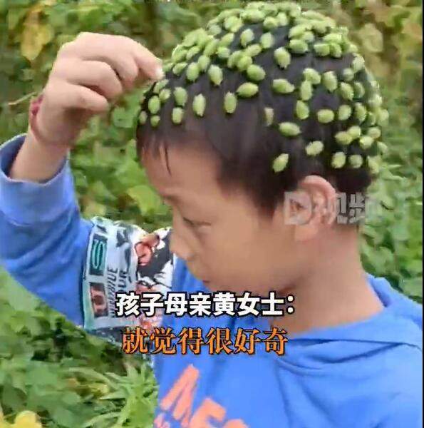7岁男童摘苍耳粘满头 这种带刺的小东西到底是个啥？