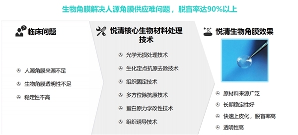 “十四五”國家重點(diǎn)研發(fā)計(jì)劃“具有生物愈合功能的復(fù)合型人工角膜系列產(chǎn)品研發(fā)”來了