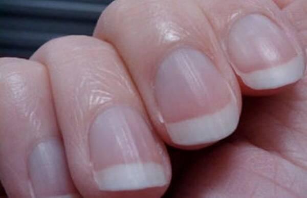 手指甲出现竖纹要留意，或是身体在发出“预警信号”