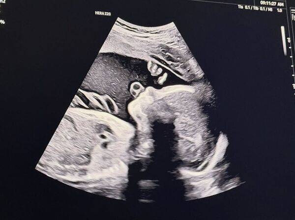 宋承炫宣布当爸 迎接新生命