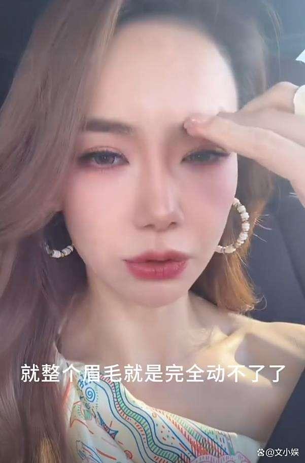 戚薇回应“吊梢眼”：打肉毒打僵了 自黑式坦诚圈粉无数