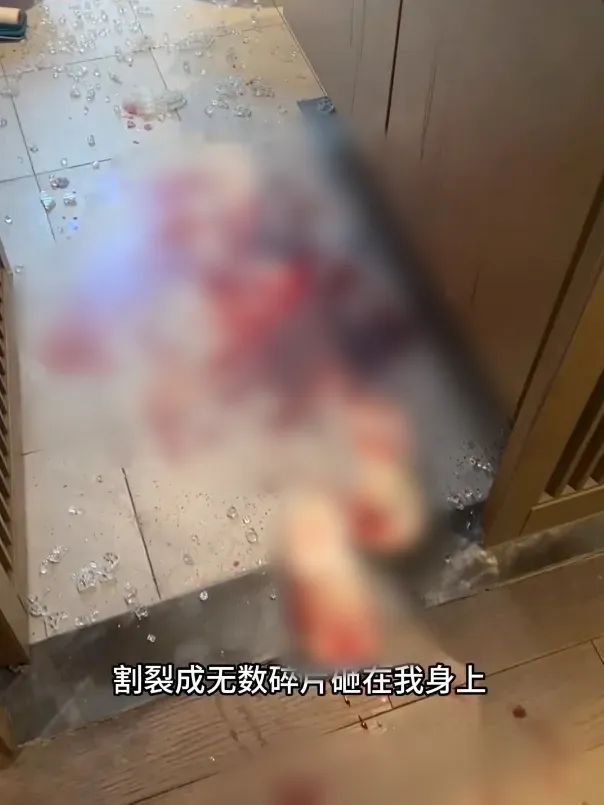 女生在出租屋洗澡玻璃門自爆 租客多處受傷縫十幾針