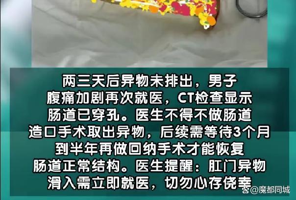 男子称不慎坐上异物滑入肛门