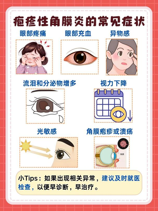 拆完快递没洗手，当心“惹”上眼部带状疱疹