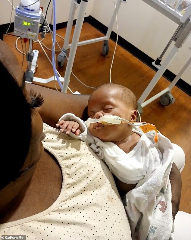 美国女子脑死亡被迫生下孩子 婴儿重病难出院