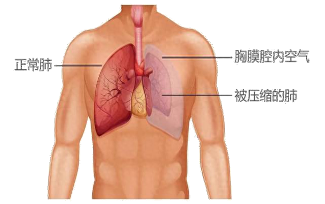 演員白宇因患?xì)庑刈鲞^(guò)6次手術(shù)