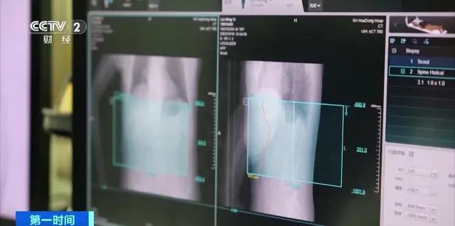 蔡國慶自曝因免疫力下降患急性帶狀皰疹 會傳染嗎幾天能好