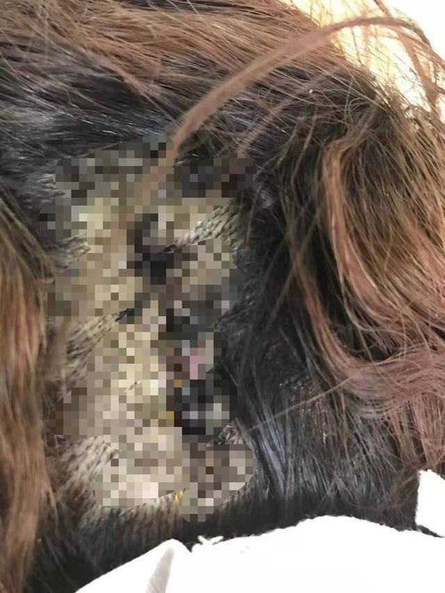 西安女大学生讨薪被老板持钢管殴打：头部缝五针 老板已被拘留