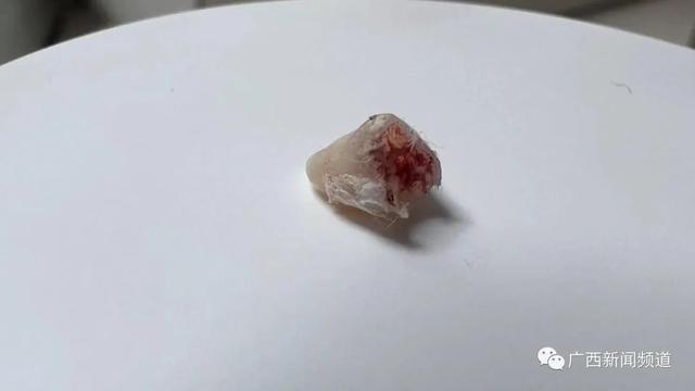 6岁男童被钢琴老师扇掉一颗牙 反让家长给自己道歉