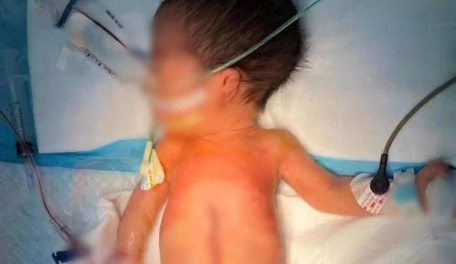 全球罕见！深圳一男婴出生时4手4脚 产妇选择生下来，医生：术后恢复良好