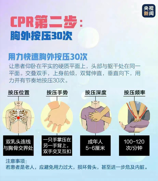 男子心跳停1小时医生持续抢救成功 正确进行心肺复苏至关重要