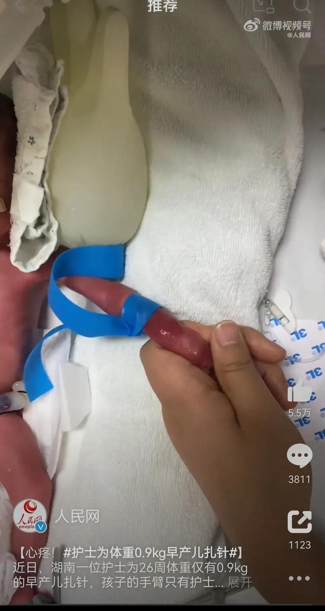 护士给0.9kg早产儿扎针：婴儿手臂只有护士手指粗，浑身紫红