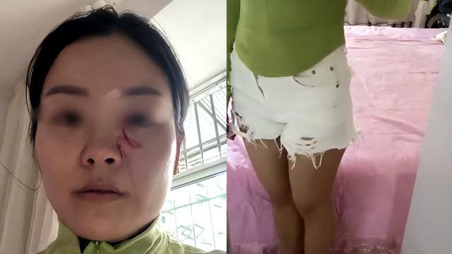 儿媳因穿短裤引公公不满 骂自己伤风败俗