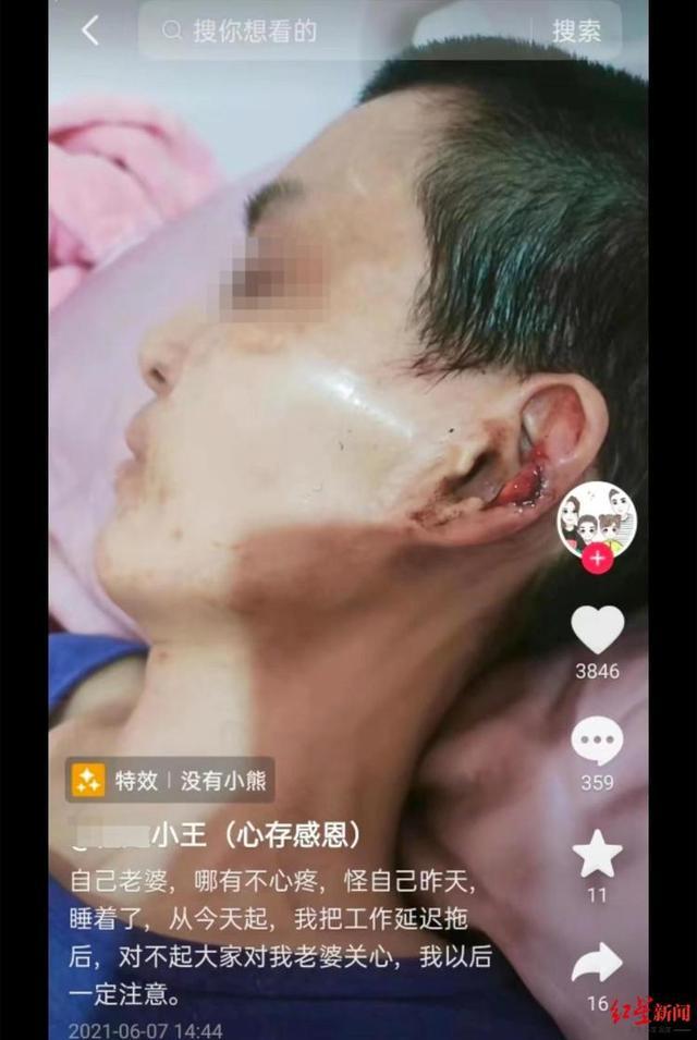 网红丈夫回应“虐待病妻”质疑：我受够了 我累了