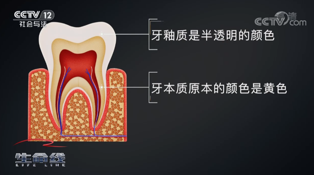 淡黄色是牙医公认的健康色号 4个因素会让牙齿变色
