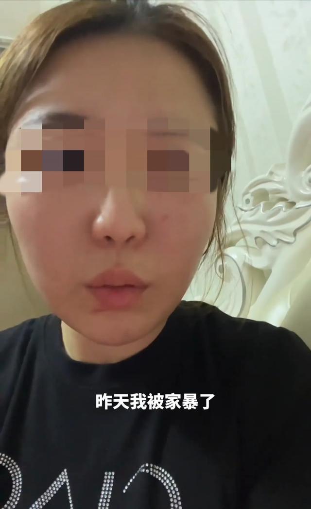 女子称被大姑姐打伤婆婆丈夫不作为 家庭暴力引众怒