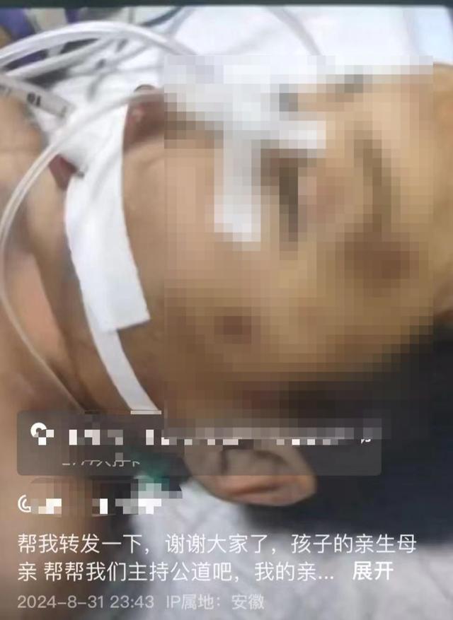 警方回应3岁男童遭生父女友虐待进ICU