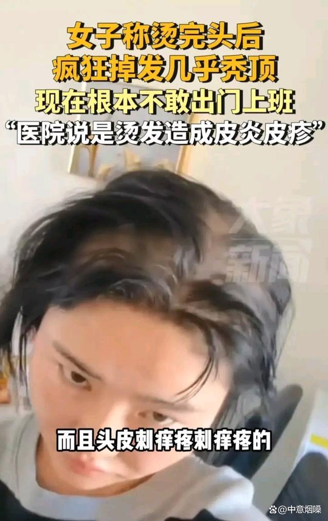 女子称烫头后疯狂掉头发