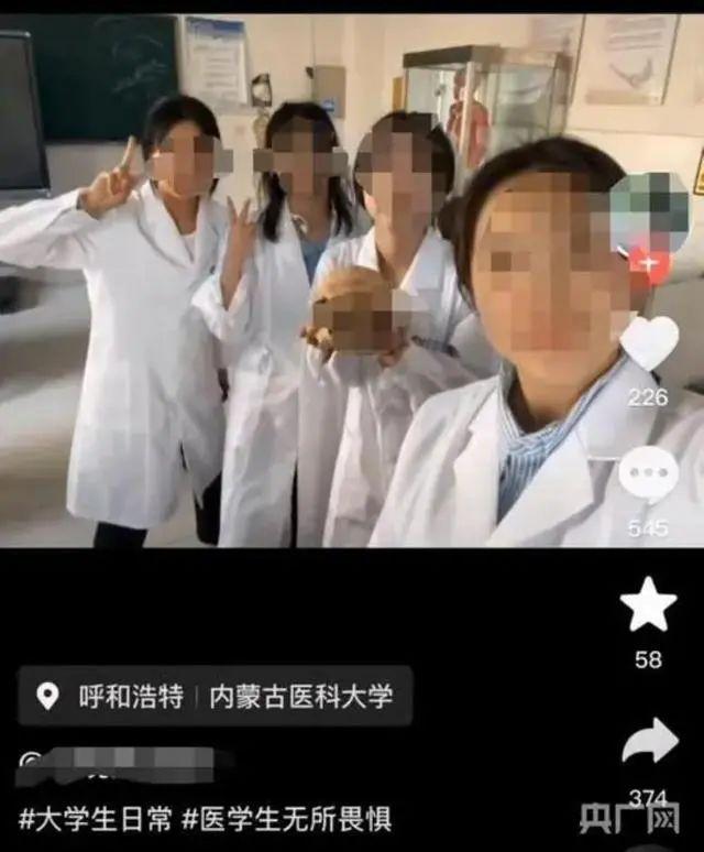 媒体评医学生与大体老师头骨合影