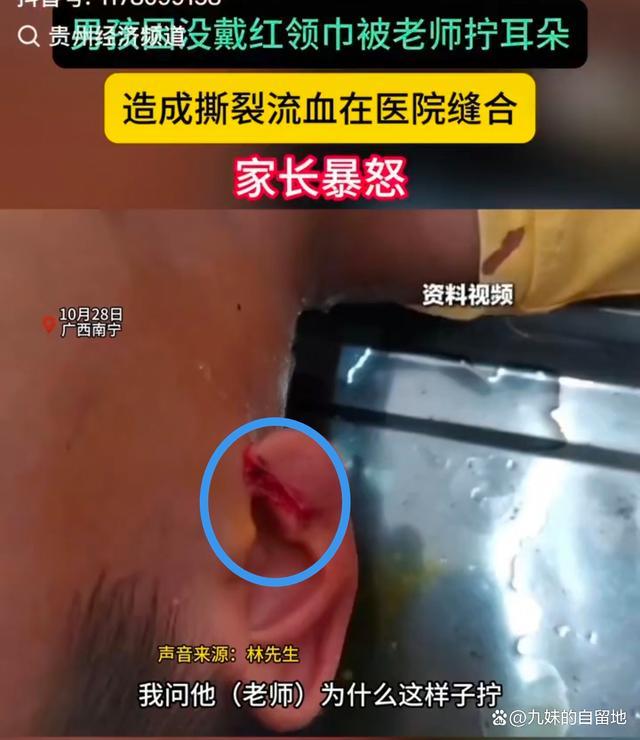 男孩没戴红领巾 老师拧其耳朵致流血 恶魔在人间