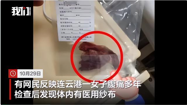 一女子手术后腹痛多年，被发现体内有医用纱布，官方回应