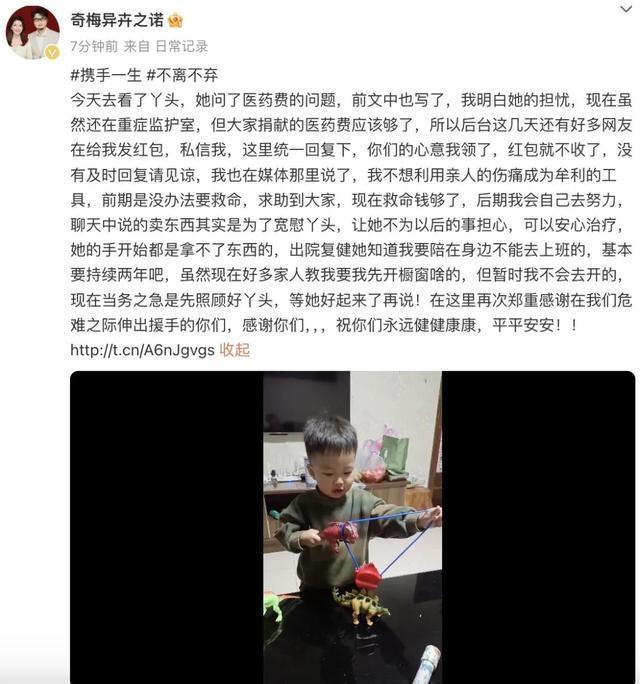 烧伤妈妈丈夫称暂时不会开橱窗