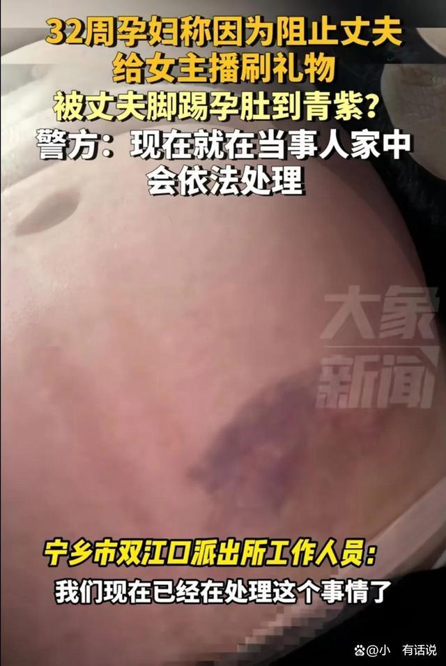 警方回答妊妇肚子被丈夫踢到青紫 因艰巨丈夫给女主播刷礼物被家暴