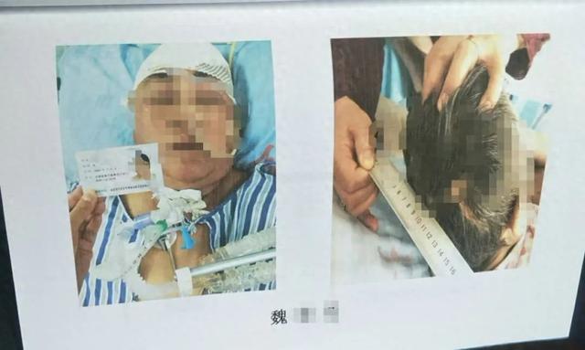 女儿目睹母亲被撞应激病倒身亡