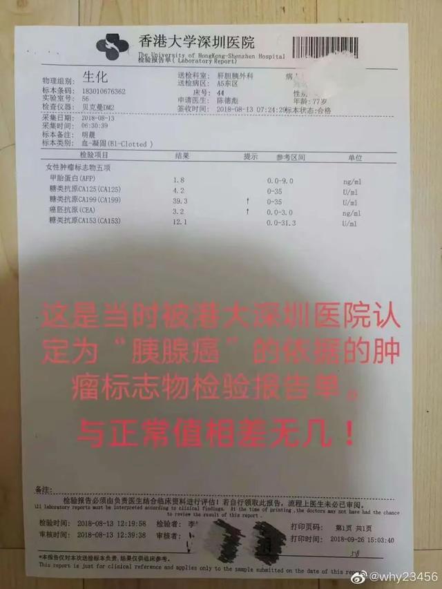 老人被误诊患癌 切除5个器官后离世！