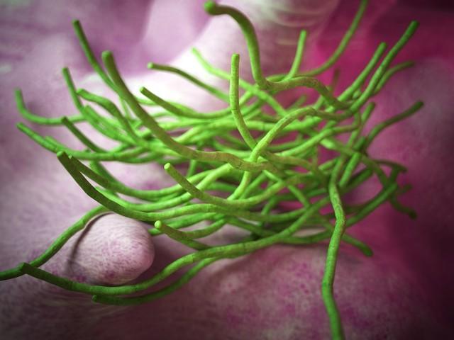 泰当局警告勿食用生牛肉 炭疽疫情引发警报